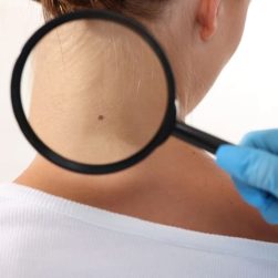 dermatology check